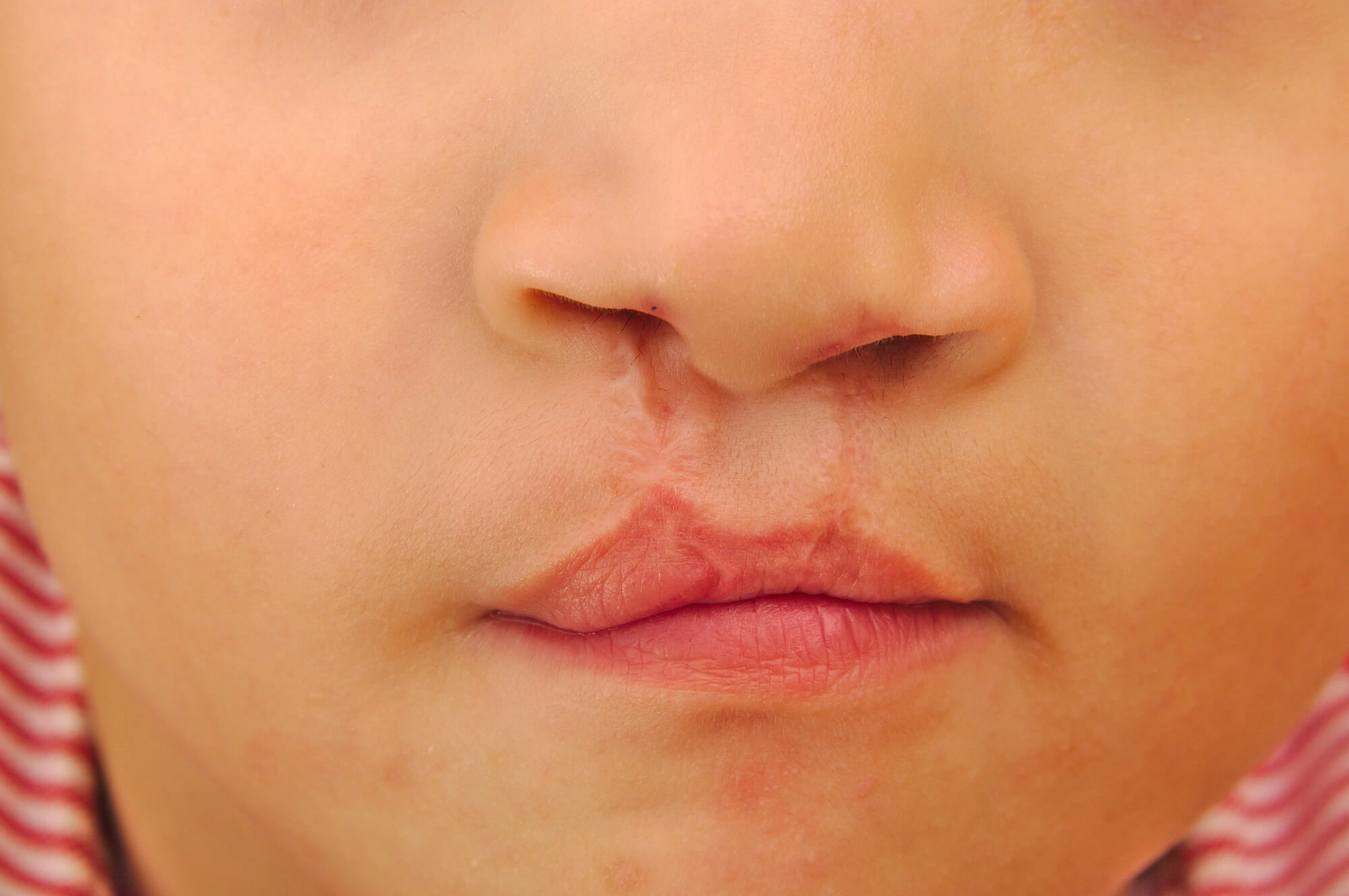 Cleft needs dentist coral springs fl