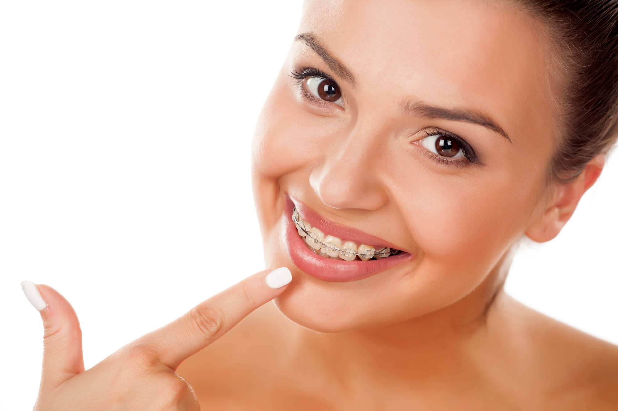 Beautiful woman pointing to Braces in Coral Springs