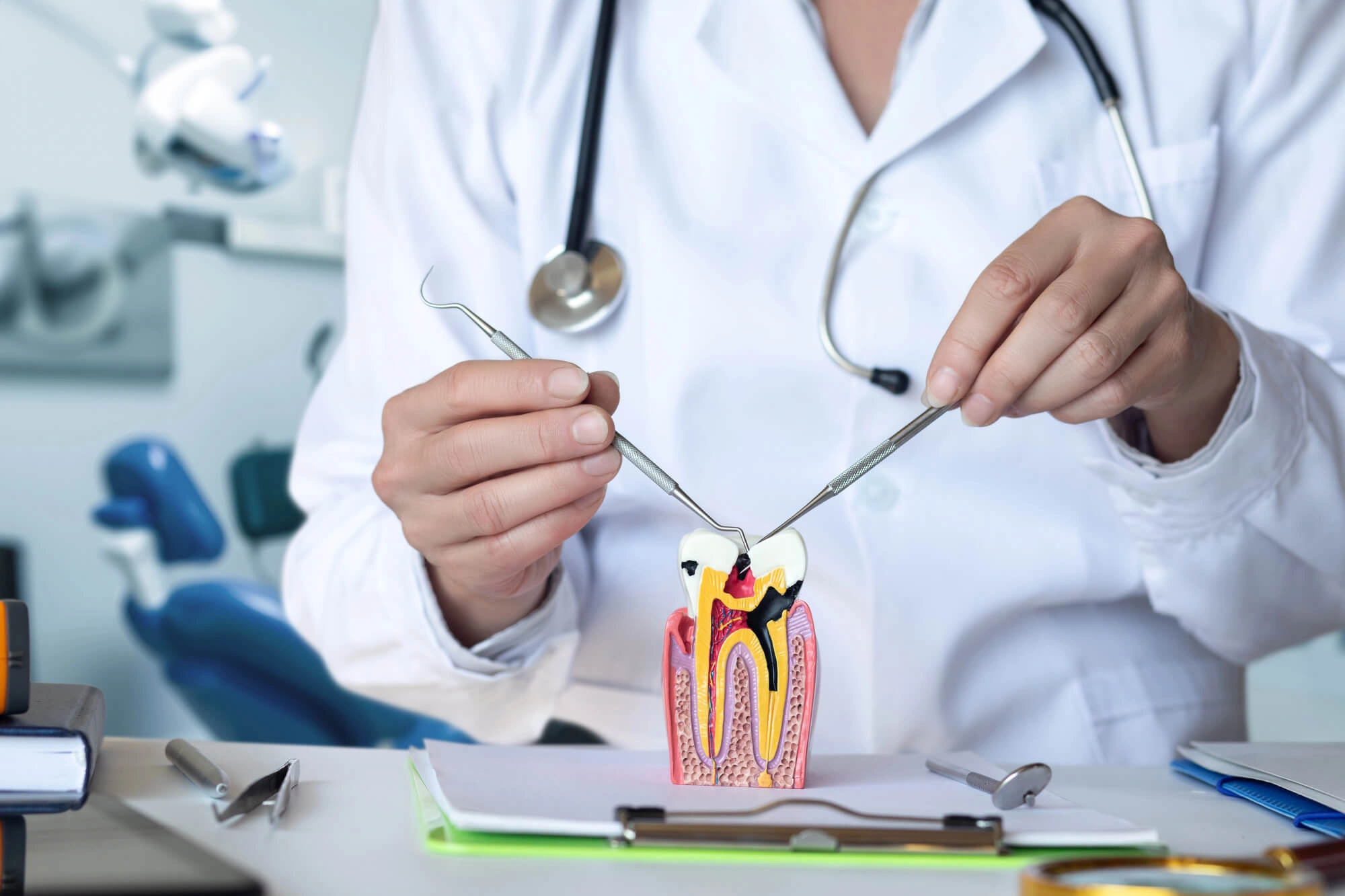 top dentists in fort lauderdale with model of root canal