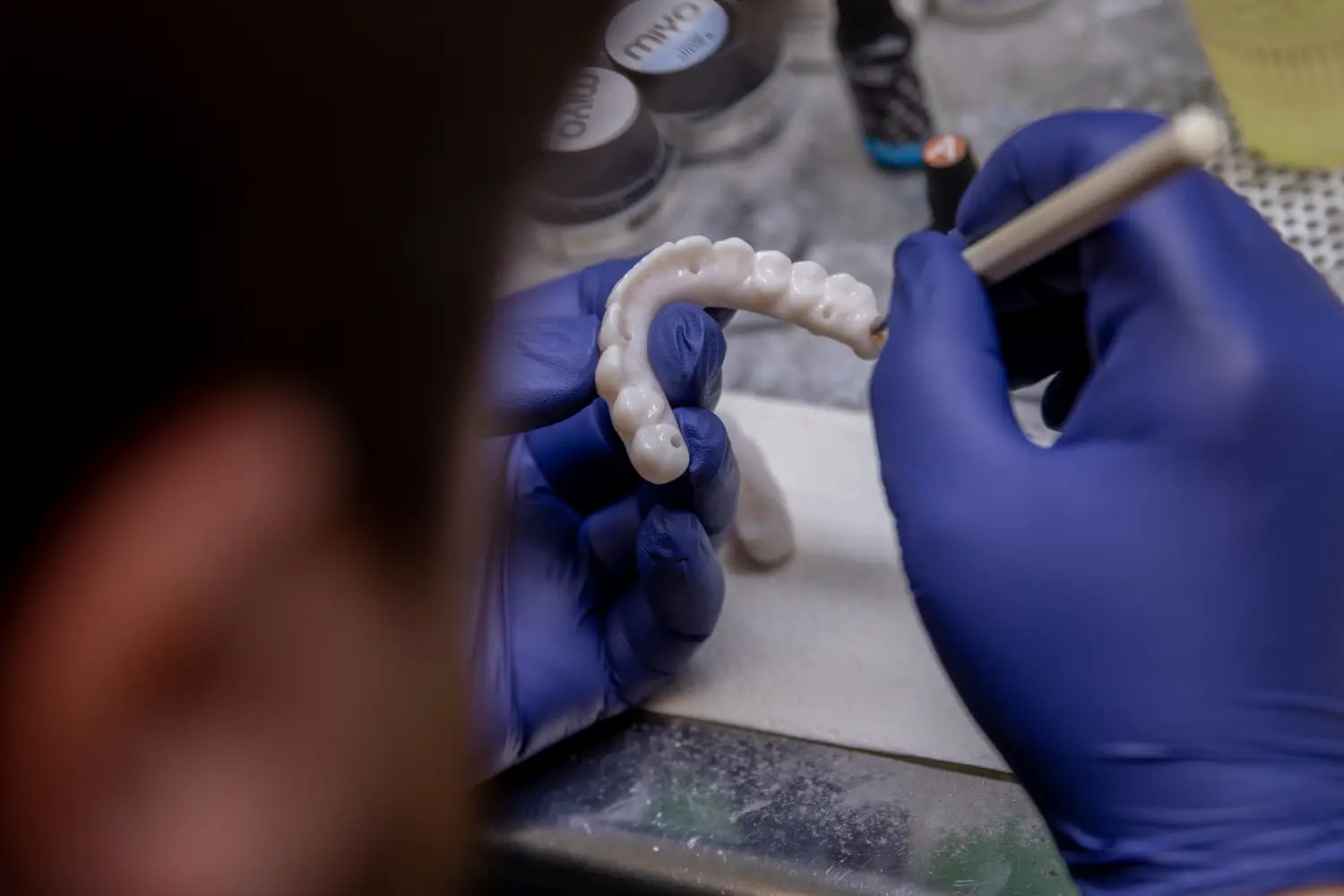 patient smiling and holding up invisalign 