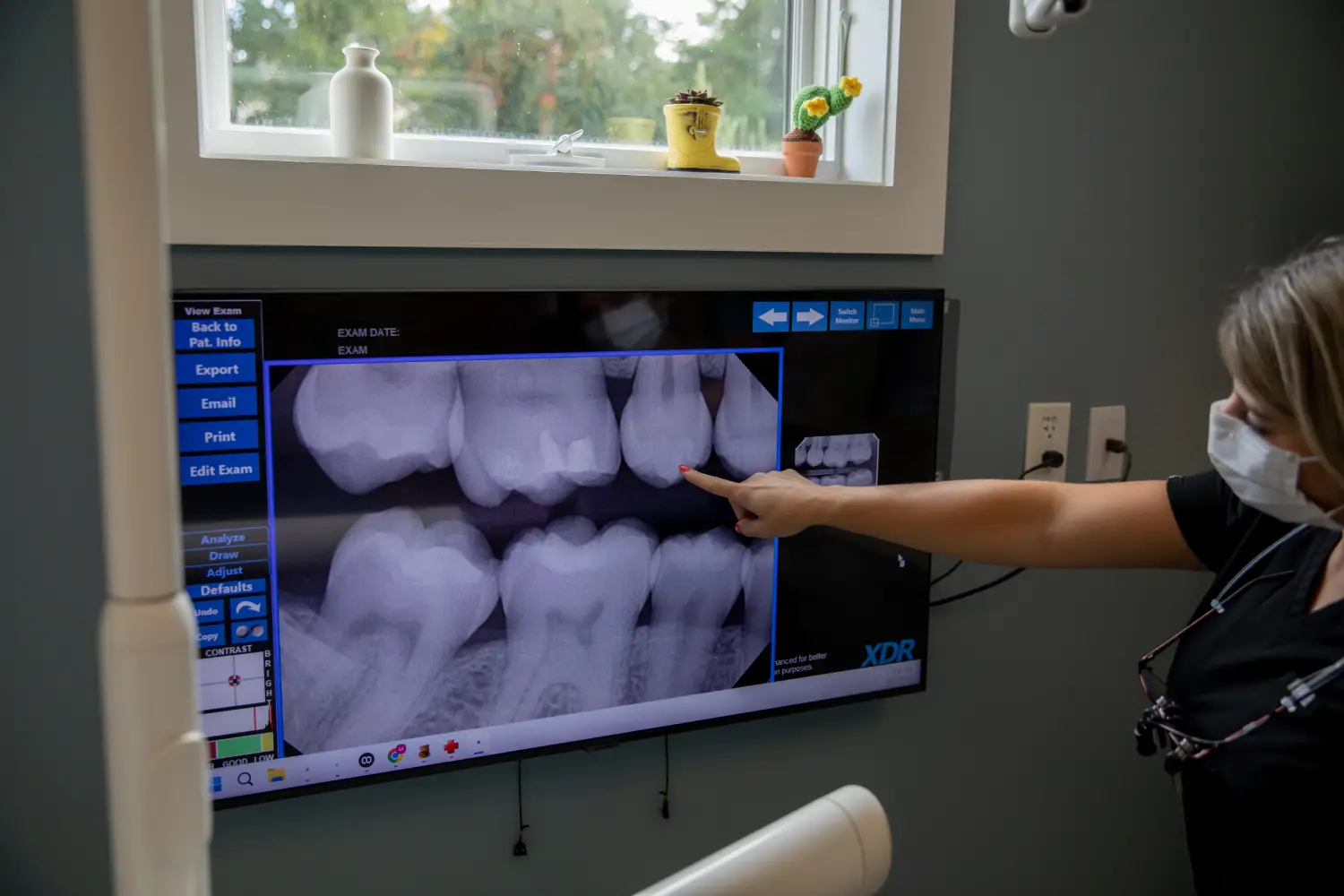 closeup of smiling teeth 