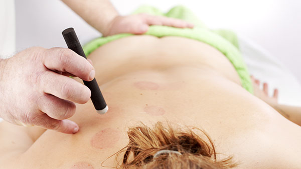 Fotografie procedury Moxování