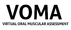 VOMA logo - Start Beyond Product