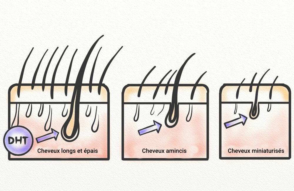 miniaturisation des cheveux