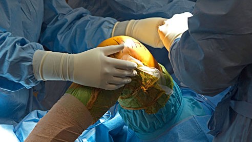patient's knee being prepared for surgery in the operating room