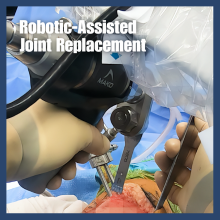 How Robotic Arm Improves Joint Replacement Precision