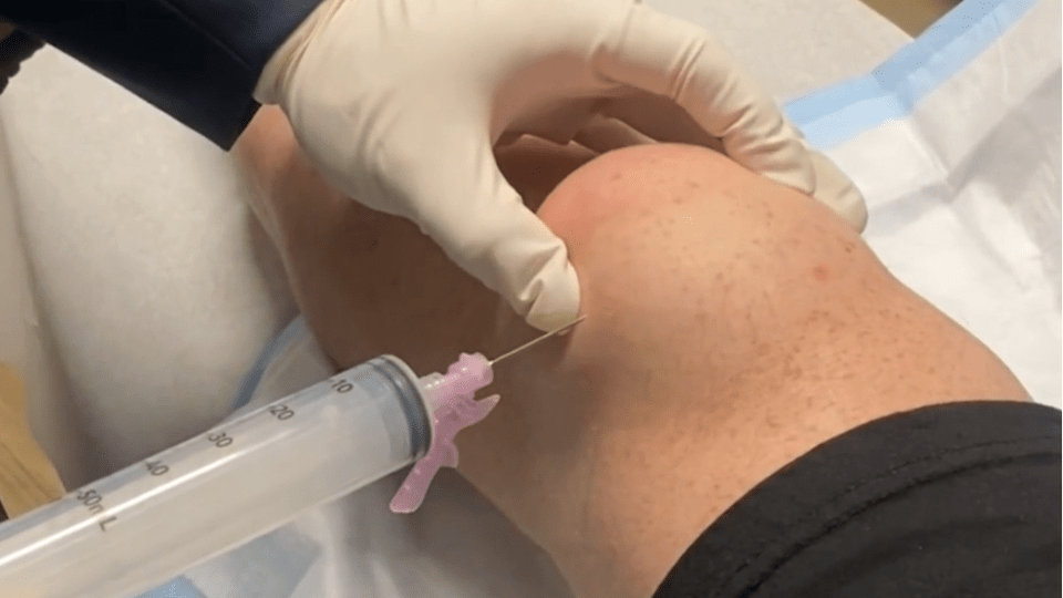 knee joint injection, Cory Calendine, MD, Nashville