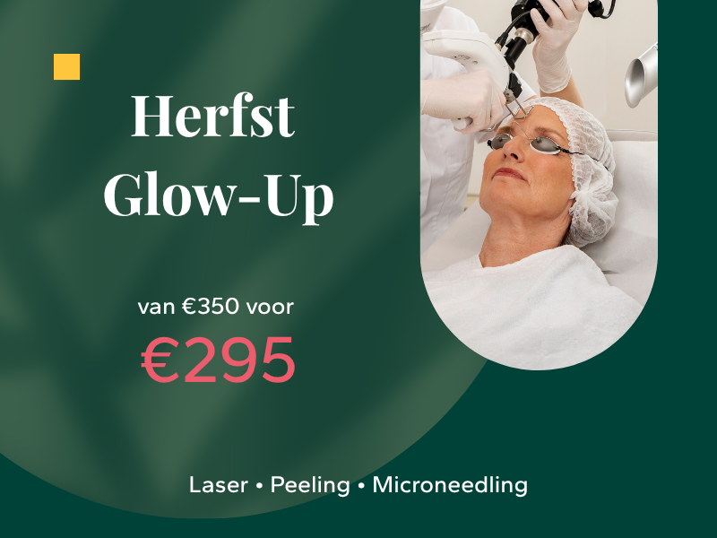 Aanbieding