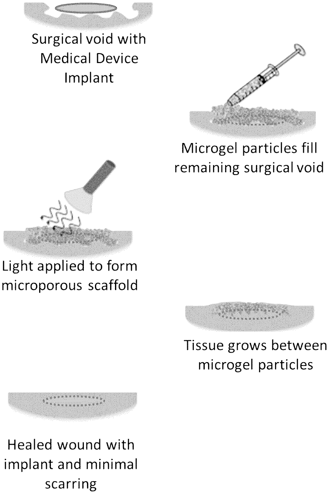 Injectable microgel scaffolds