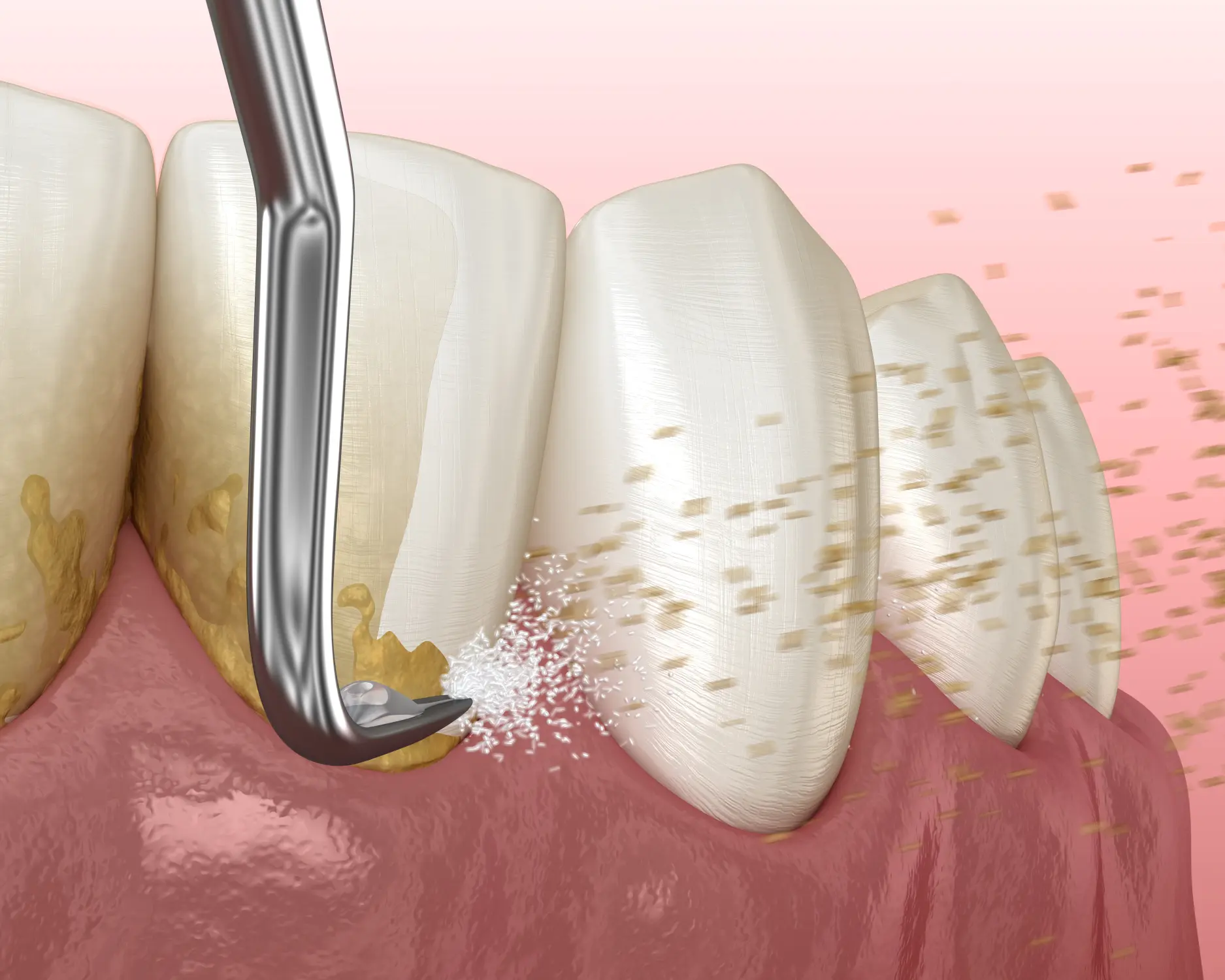 TMJ Treatment Windsor