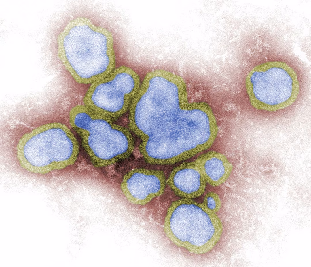 Le virus de la grippe en mode zoom au microscope.