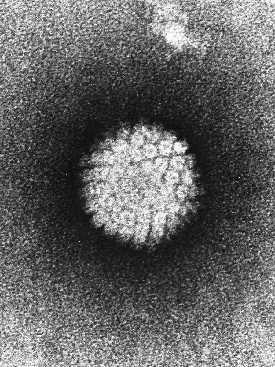 L'image de ce qui semble être un papillomavirus hpv vu au microscope.