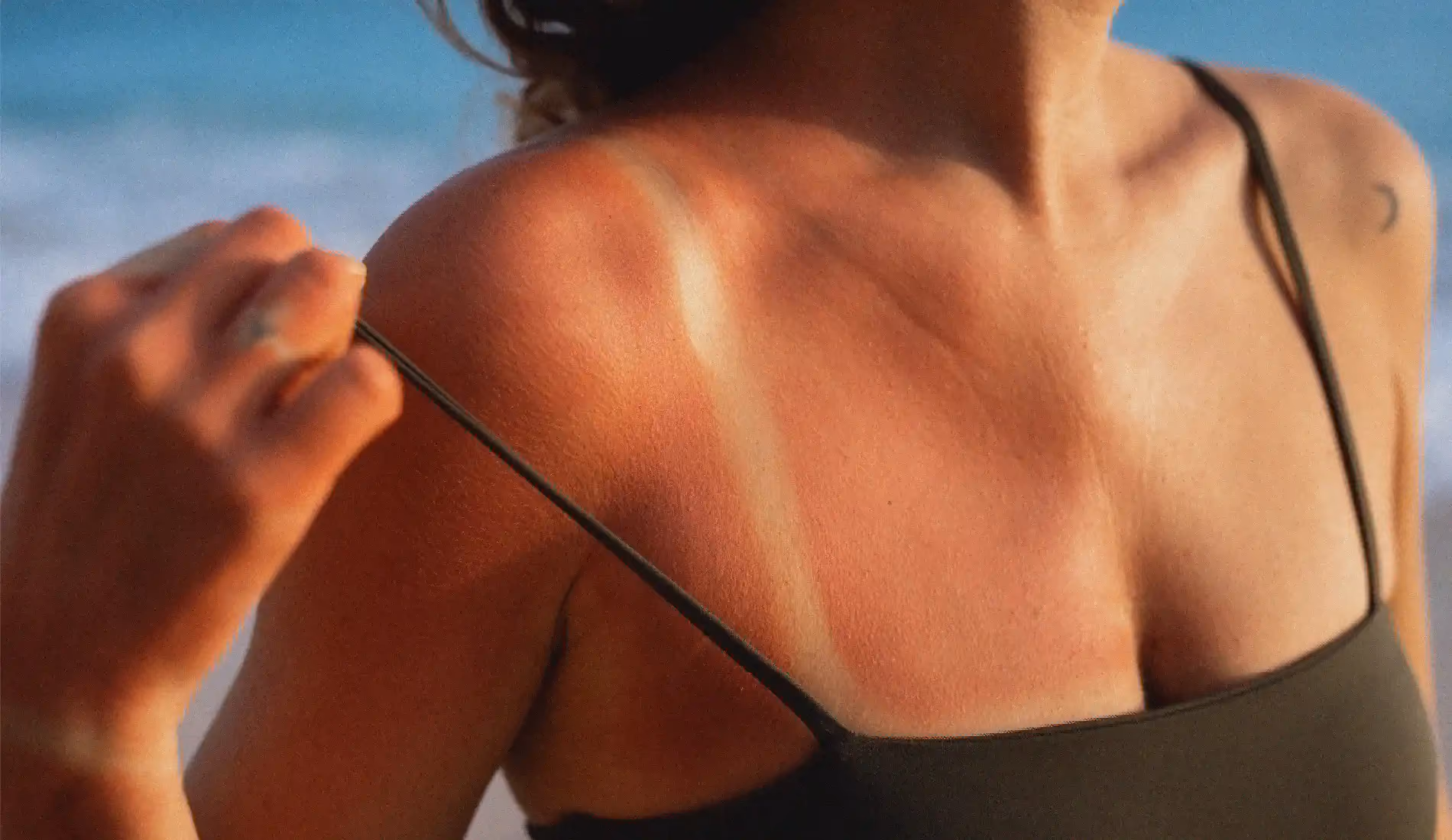 Coup de soleil
