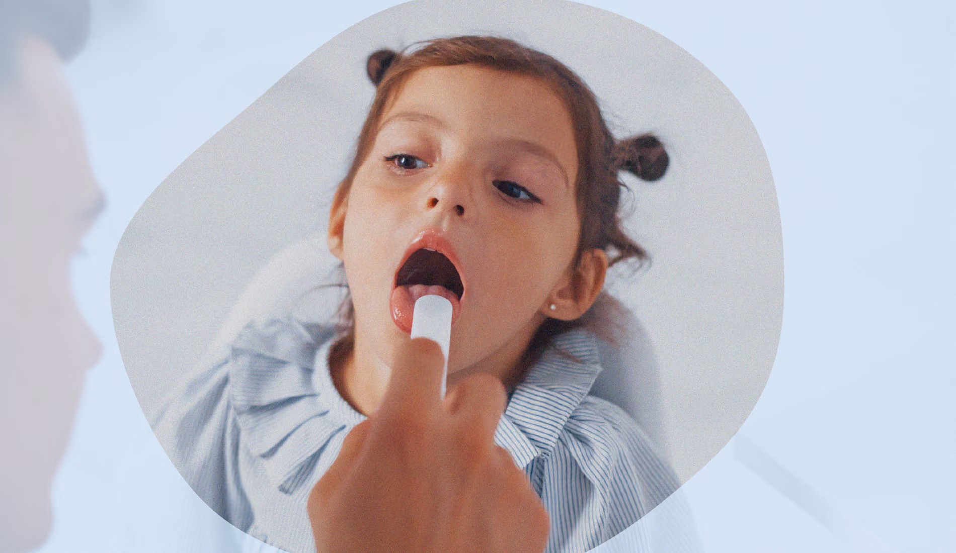 Un petit enfant atteint d'angine blanche se fait ausculter.