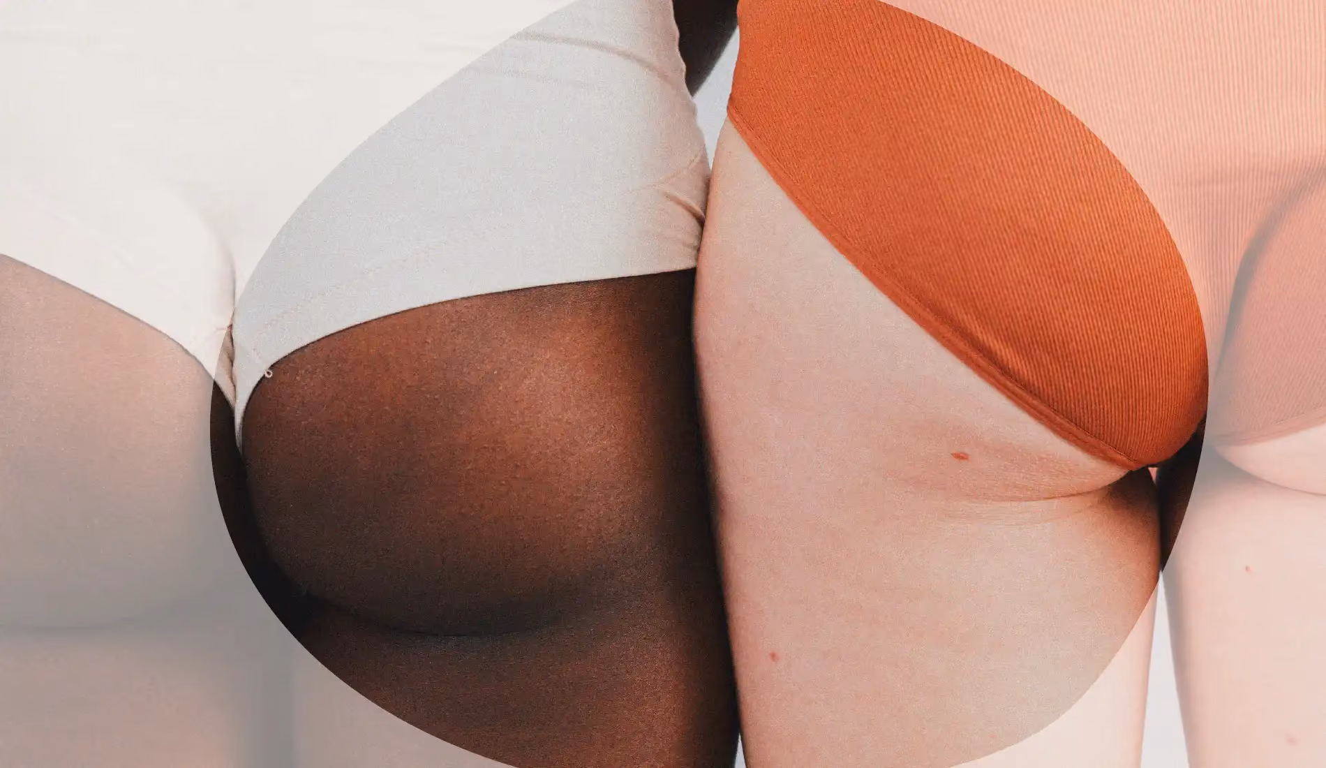 Deux paires de fesses (blanches et noires) pour évoquer les condylomes.