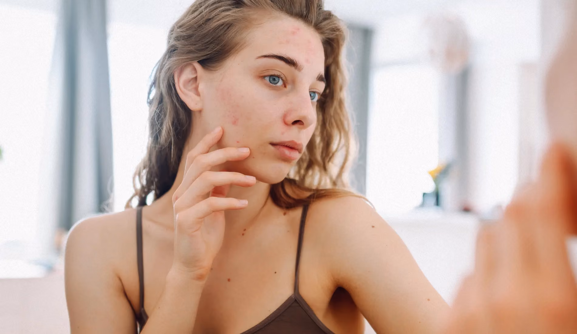 Femme fatiguée et pensive, se demandant si ses symptômes sont liés à un dérèglement hormonal