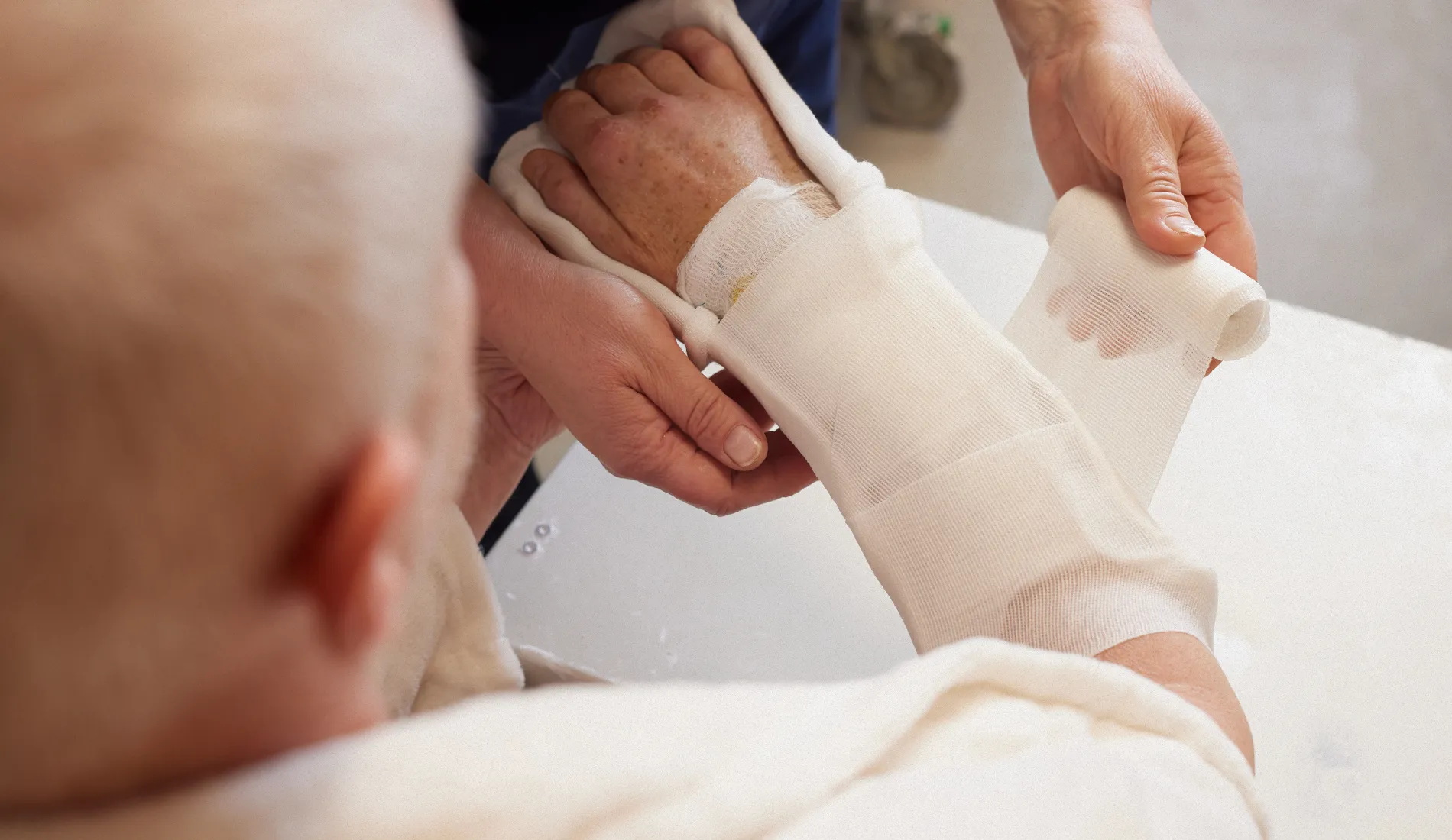 Bras plâtré maintenu en écharpe après une fracture, illustrant les gestes essentiels pour surveiller et gérer son plâtre au quotidien.