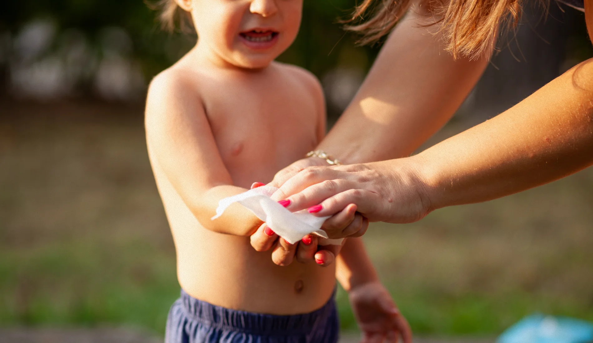 Enfant avec un pansement sur la zone brûlée, illustrant la prise en charge d'une brûlure superficielle chez l'enfant à domicile.