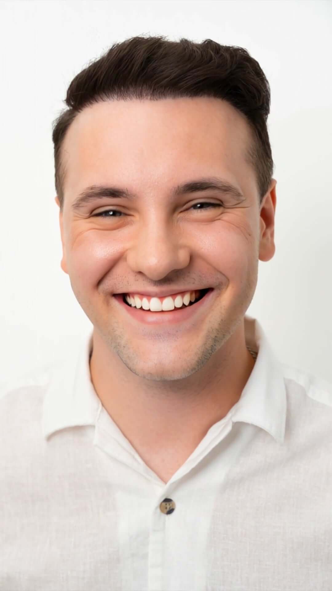 Hair Transplant Male