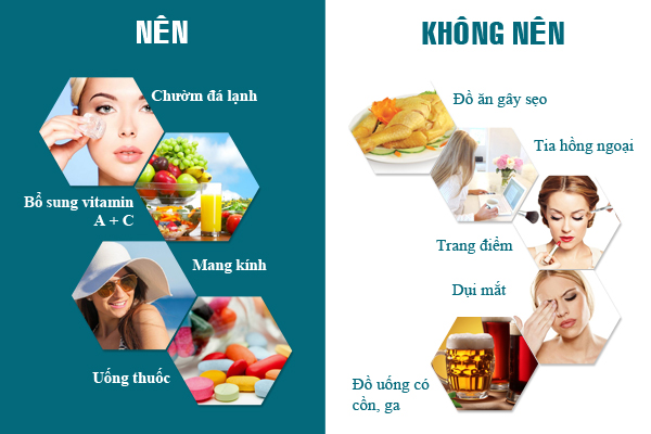 Cắt mí mắt bao lâu thì lành