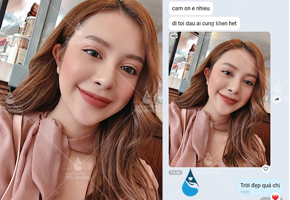 Khách cắt mắt 2 mí thành công