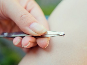 A person's hand holding tweezers that have just pulled a tick out of another person's skin.