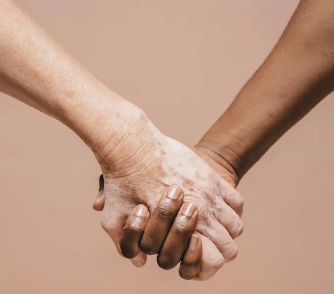 Women Holding Hands To Symbolize Physical Therapy For Women.