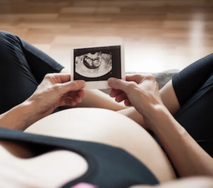 A pregnant woman looking at an ultrasound image and worrying about gestational diabetes.