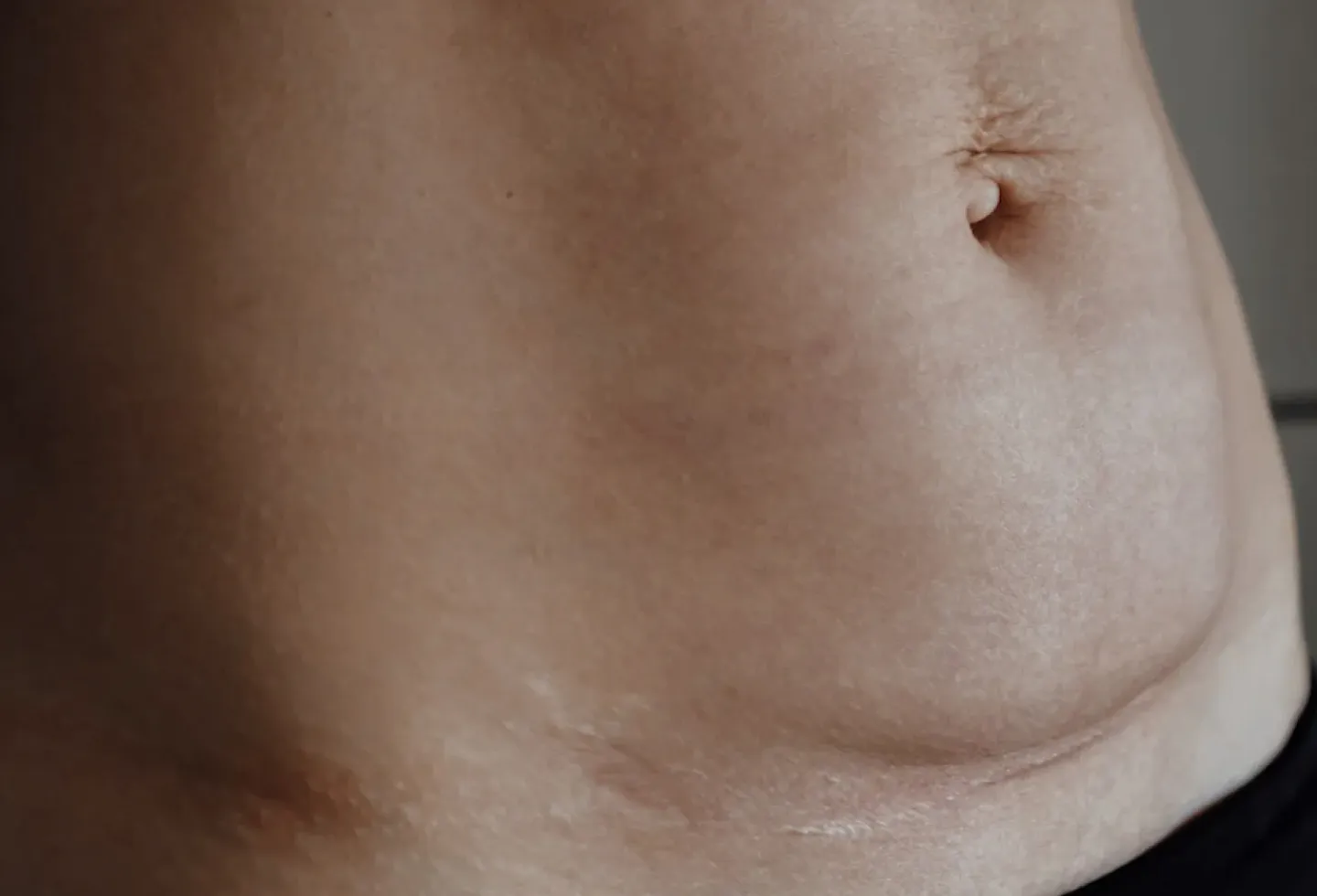 A mom and newborn baby after a c-section delivery.