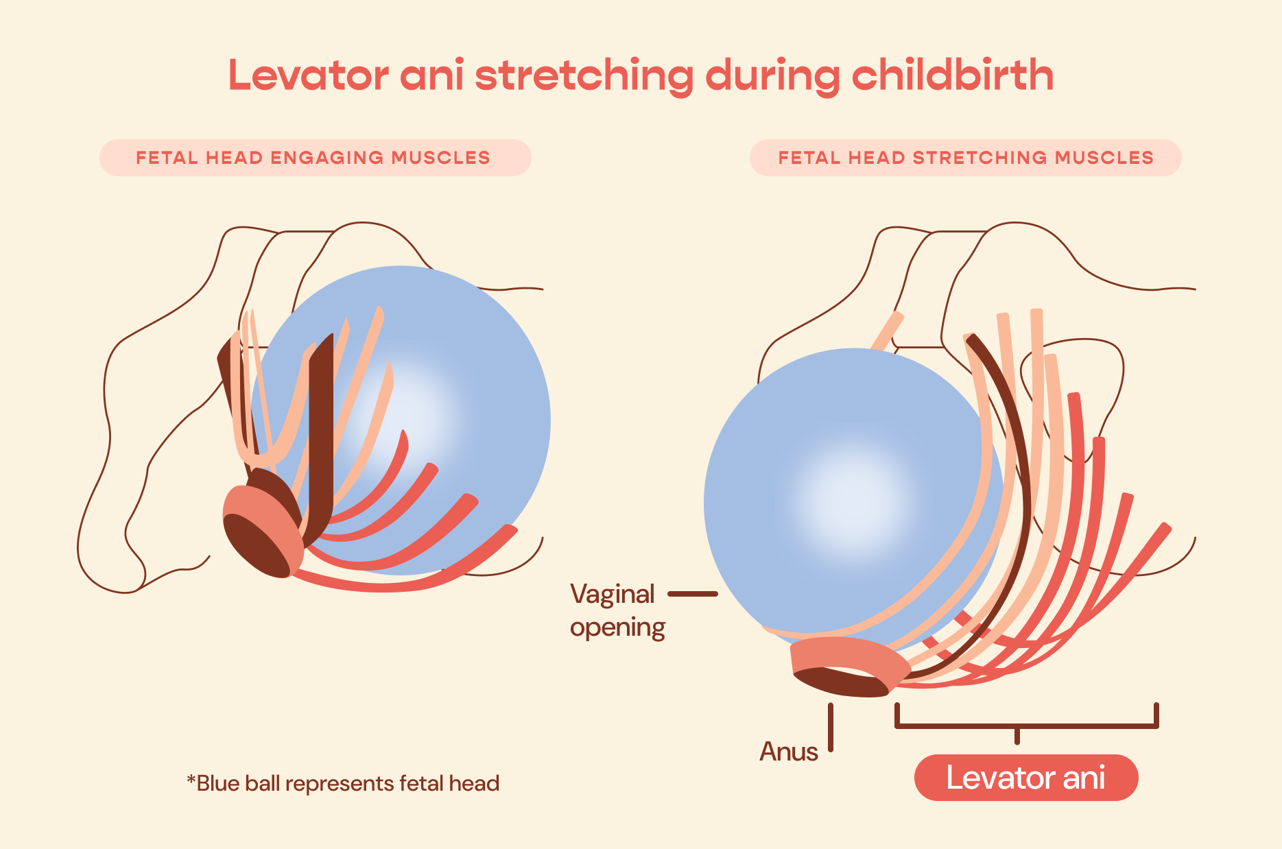 Illustration of levator ani muscles stretching during childbirth