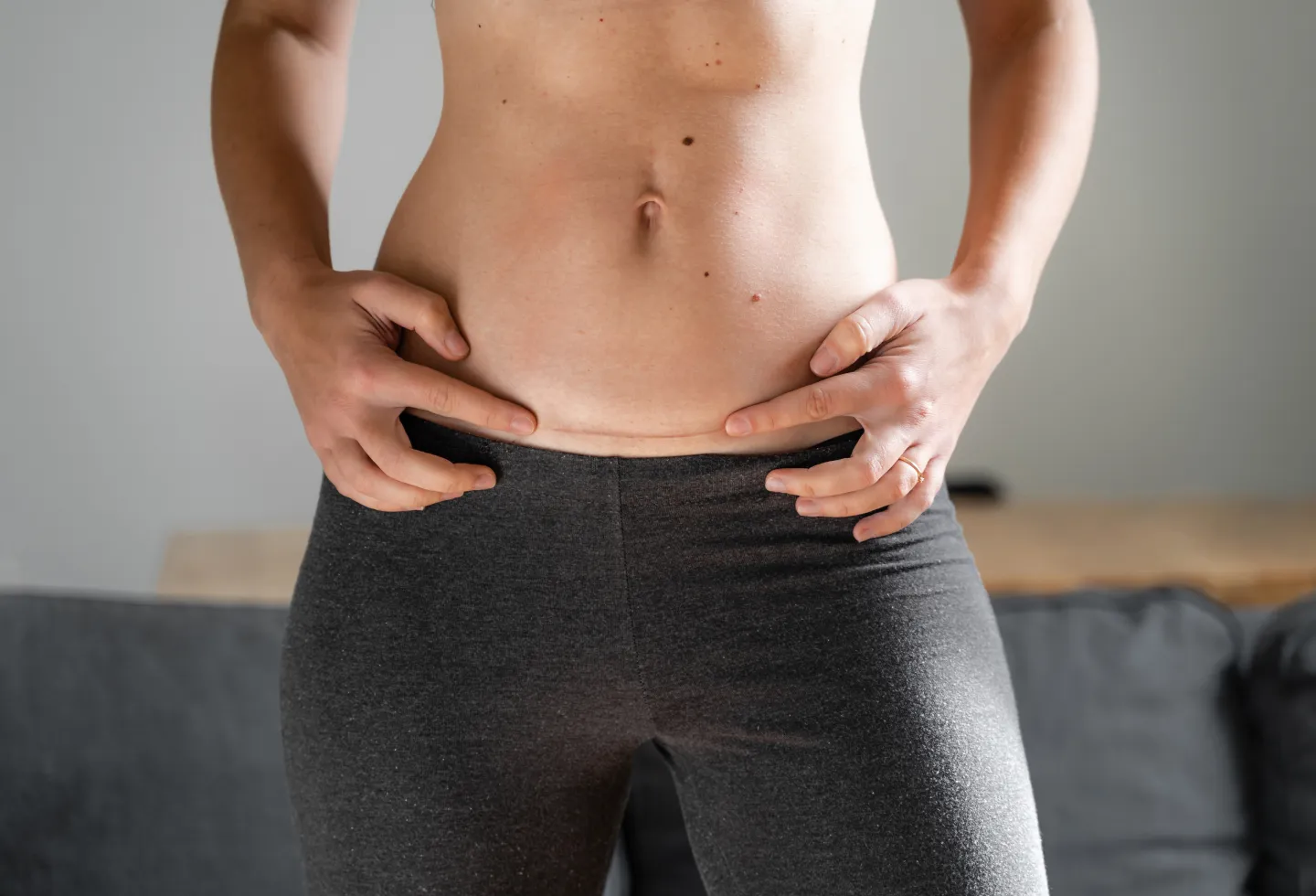 Woman who had a hysterectomy representing hysterectomy prep: what to expect and how to prepare.