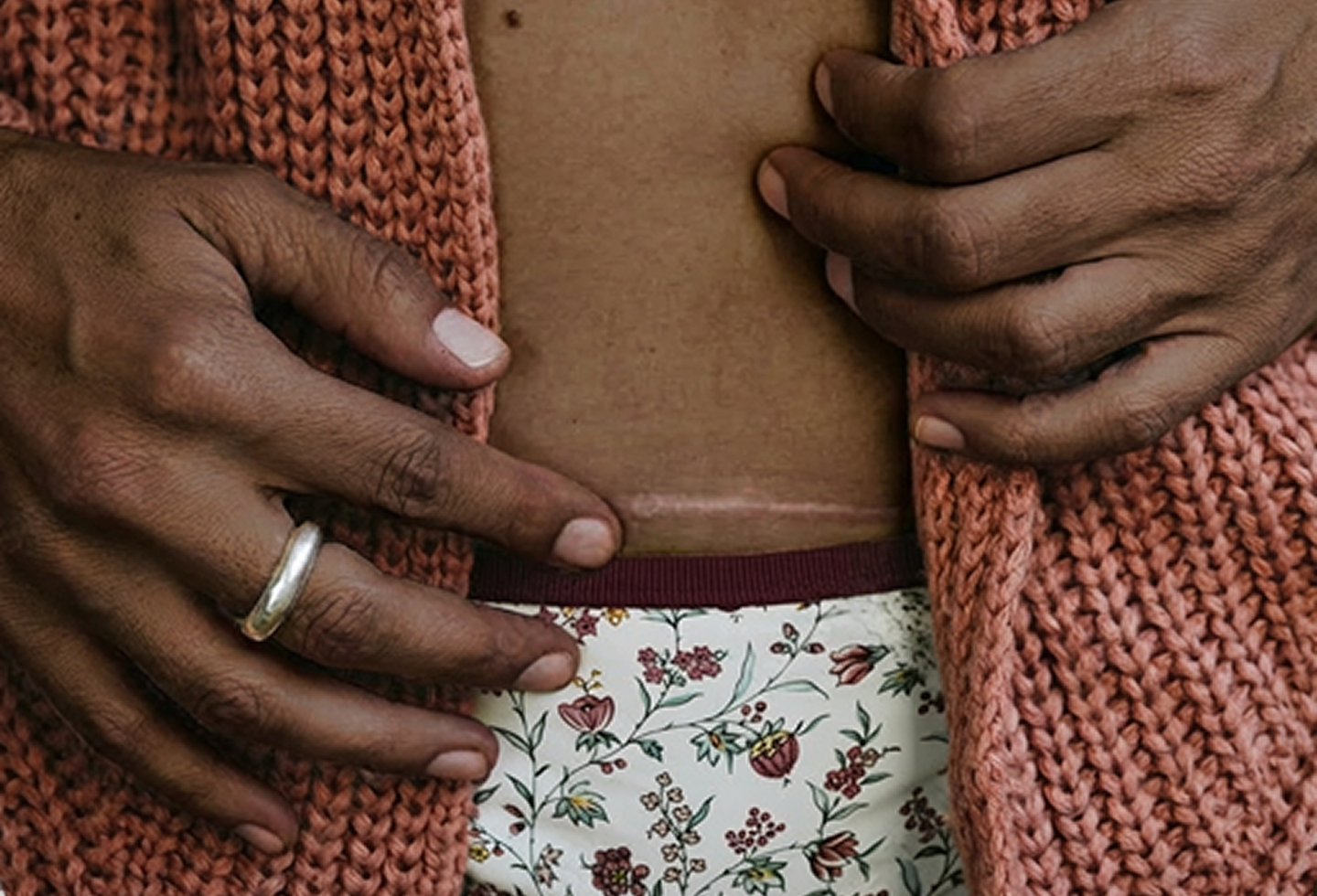 Woman with c-section nerve issues doing pelvic floor physical therapy