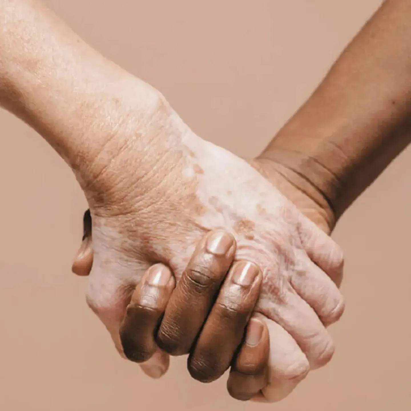 Women Holding Hands To Symbolize Physical Therapy For Women.