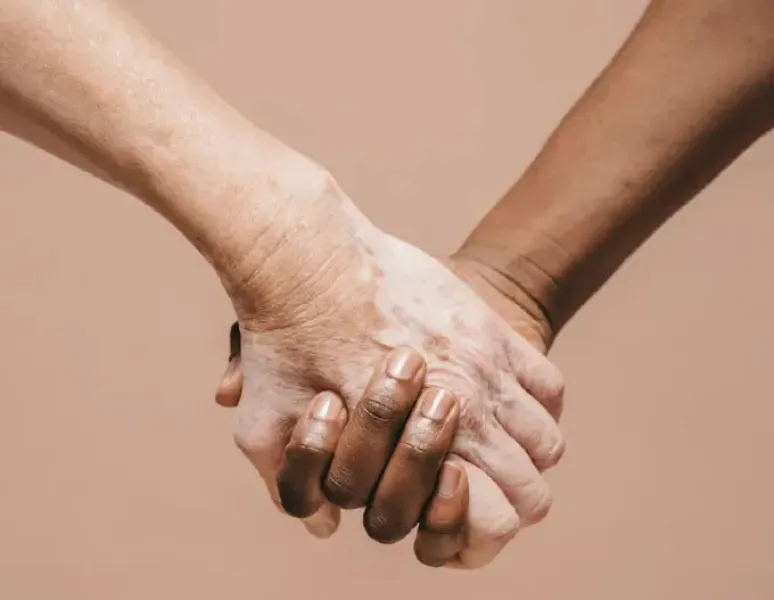 Women Holding Hands To Symbolize Physical Therapy For Women.