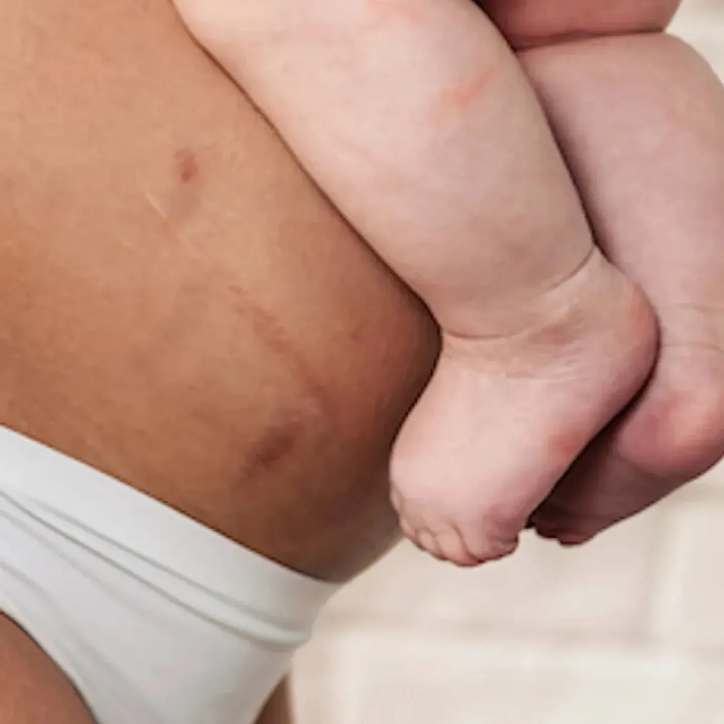 A woman holding her baby close to her postpartum belly above her c-section scar.
