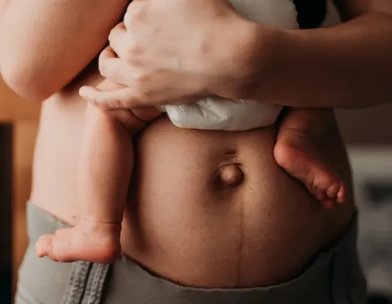 A postpartum person holding their baby for a story about c-section scar healing stages.