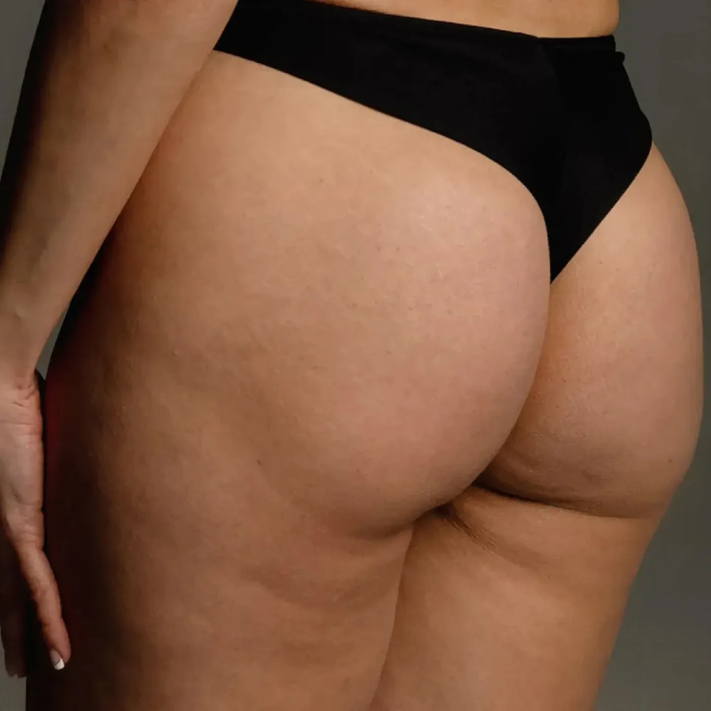 A close up of a postpartum person's butt.