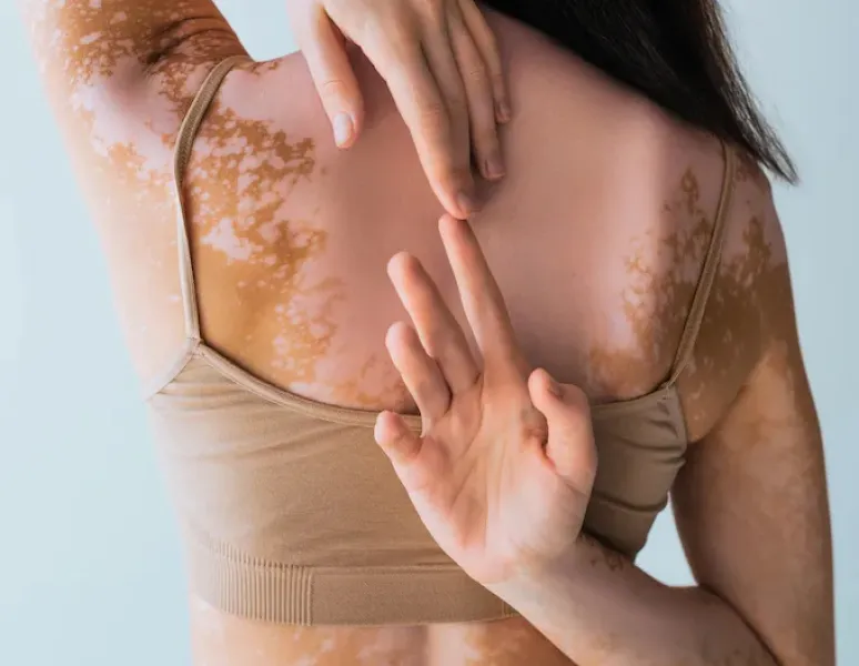 A woman touching the tips of her fingers behind her back for a story on hypermobility.