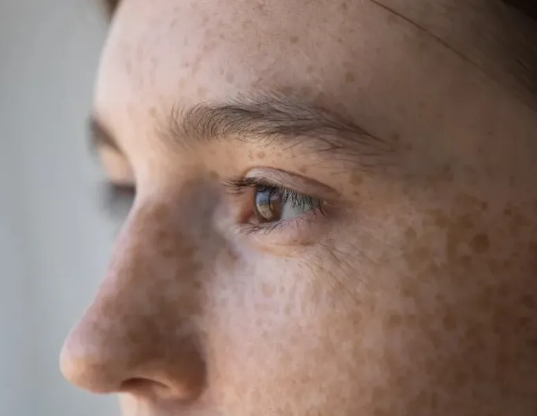 A zoomed-in portrait of a woman dealing with pelvic pain due to stress and anxiety.