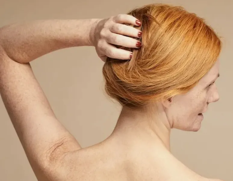 A woman in menopause unable to move her frozen shoulder.
