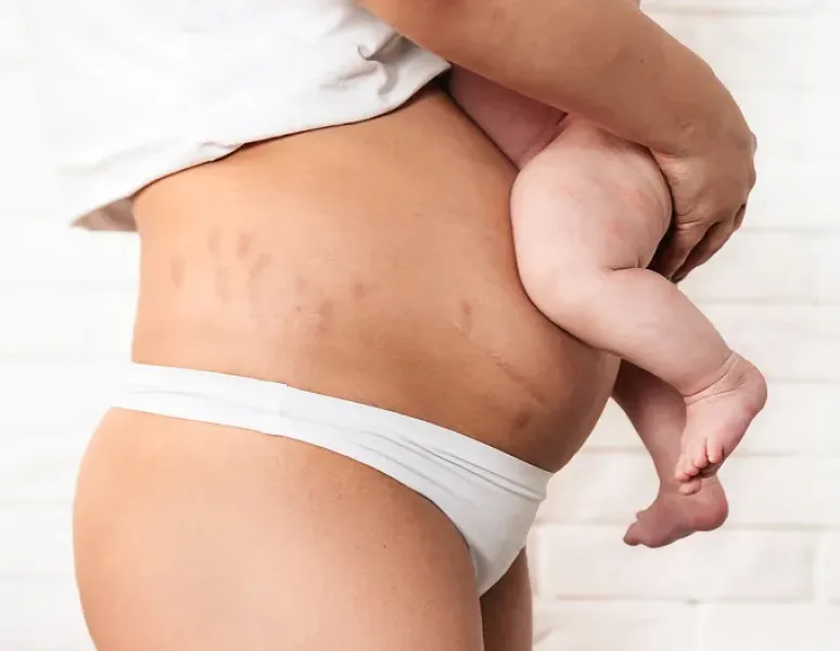 New mother holding her baby, representing the postpartum recovery milestones nobody talks about.