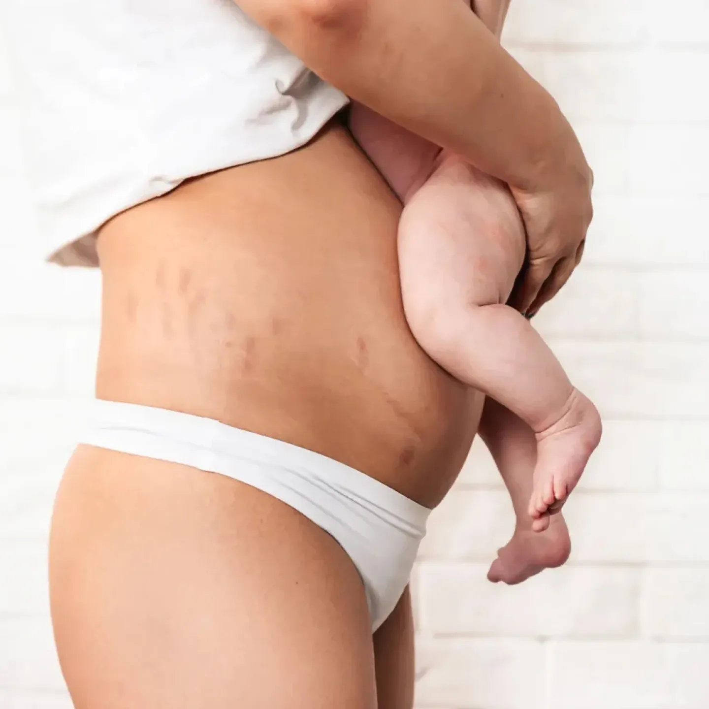 Postpartum mother with levator ani birth injury holding newborn baby.
