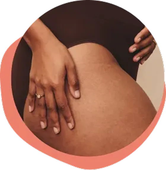 A woman with pelvic organ prolapse holding her abdomen.