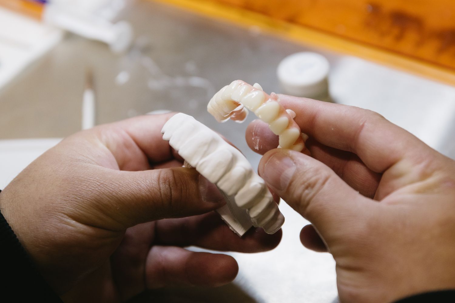 Photo of a dental model