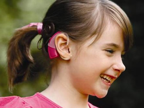 cochlear implant 500