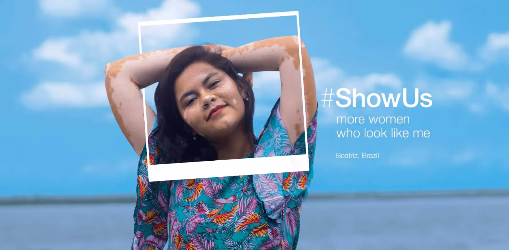 Dove’s #ShowUs Campaign