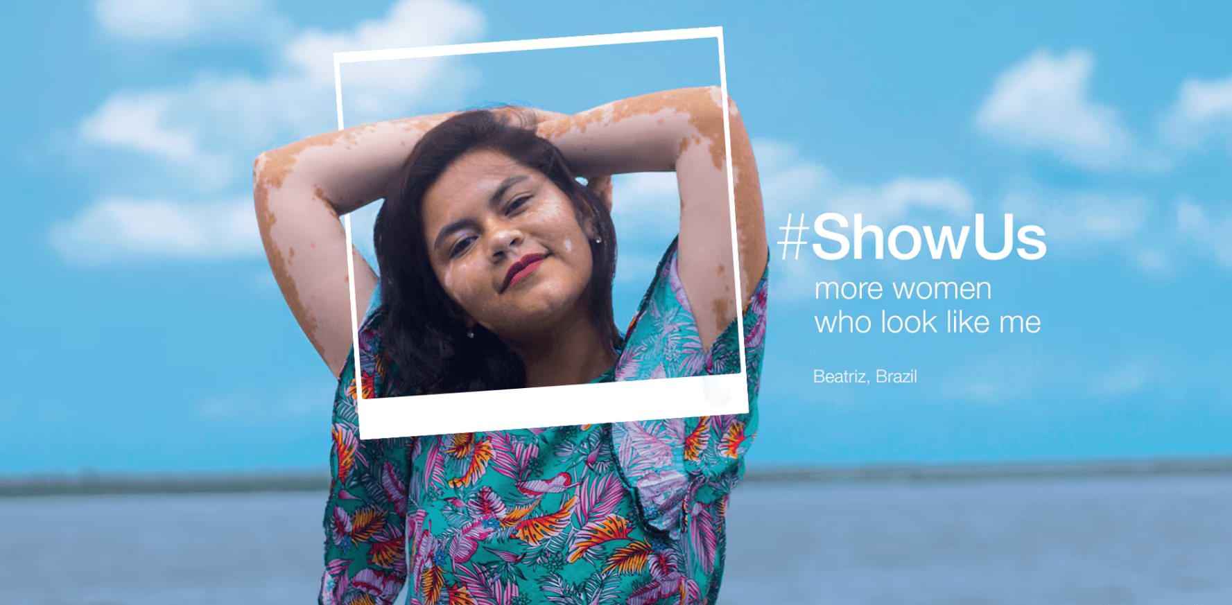 Dove’s #ShowUs Campaign