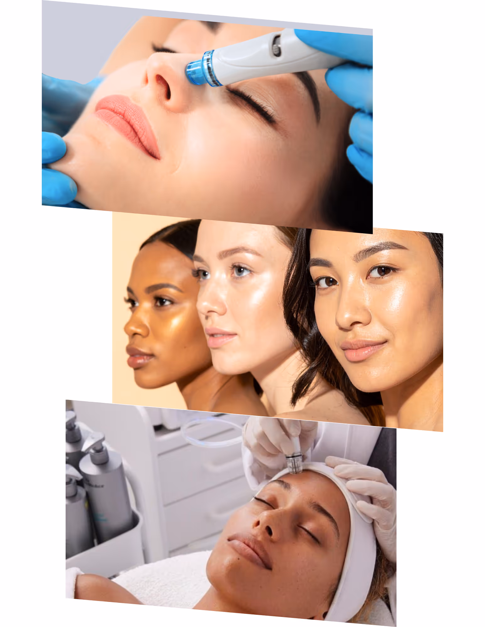 Coolsculpting machine