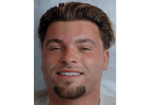 Jake Cornish on Skincare at Este Bristol