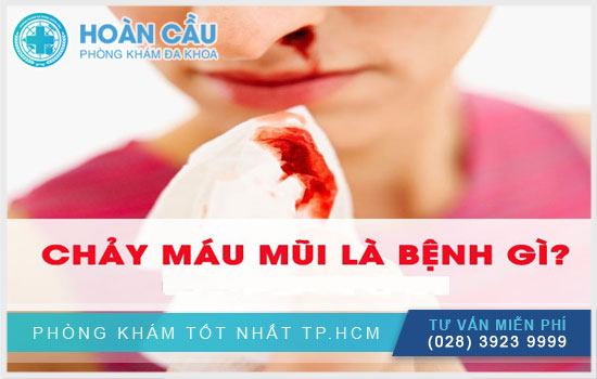 Viêm mũi chảy máu là gì?